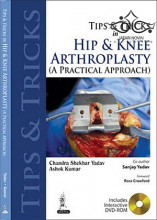 Tips and Tricks in Hip and Knee Arthroplasty2014