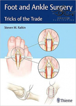Foot and Ankle Surgery: Tricks of the Trade2018
