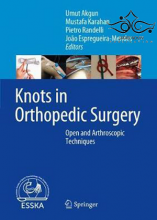 Knots in Orthopedic Surgery: Open and Arthroscopic Techniques2018