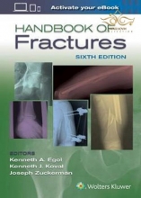 2020 Handbook of Fractures Sixth Edition