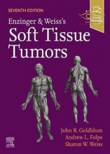 2020 Enzinger and Weiss's Soft Tissue Tumors 7th Edition