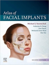 Atlas of Facial Implants 2nd Edition
