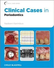 Clinical Cases in Periodontics 1st Edition