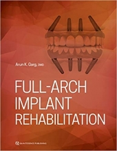 Full-Arch Implant Rehabilitation 1st Edition