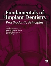Fundamentals of Implant Dentistry: Prosthodontic Principles