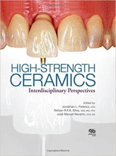 High-Strength Ceramics 1st Edition