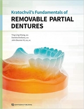 Kratochvil’s Fundamentals of Removable Partial Dentures
