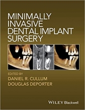 Minimally Invasive Dental Implant Surgery, 1st Edition