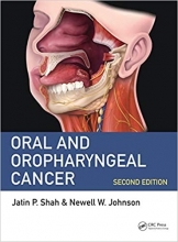 Oral and Oropharyngeal Cancer 2nd Edition