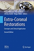 Extra-Coronal Restorations : Concepts and Clinical Application