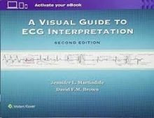 A Visual Guide to ECG Interpretation Second Edition2016