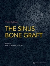 The Sinus Bone Graft 3rd Edition2019