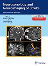 Neurosonology and Neuroimaging of Stroke, 2nd Edition2017