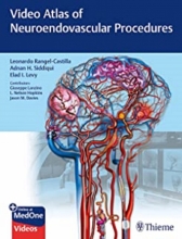 Video Atlas of Neuroendovascular Procedures 1st Edition2020