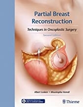 Partial Breast Reconstruction, 2nd Edition2017
