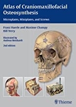 Atlas of Craniomaxillofacial Osteosynthesis : Microplates, Miniplates,and Screws