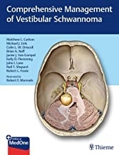 Comprehensive Management of Vestibular Schwannoma 1st Edition2019