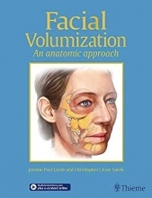 Facial Volumization: An Anatomic Approach