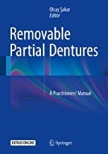 Removable Partial Dentures: A Practitioners’ Manual 1st ed. 2016 Edition, Kindle Edition
