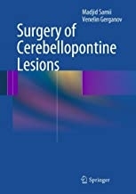 Surgery of Cerebellopontine Lesions2013
