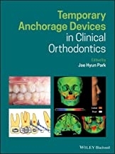 Temporary Anchorage Devices in Clinical Orthodontics2020