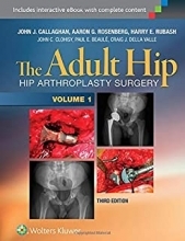 The Adult Hip (Two Volume Set) : Hip Arthroplasty Surgery