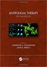 Antifungal Therapy 2nd Edition, Kindle Edition