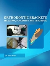 Orthodontic Brackets: Selection,Placement and Debonding2015