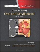 Diagnostic Imaging: Oral and Maxillofacial 2nd Edition2017