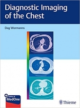Diagnostic Imaging of the Chest2020