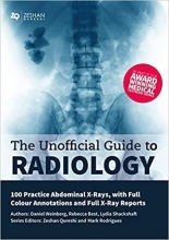 The Unofficial Guide to Radiology: 100 Practice Abdominal X Rays with Full Colour Ann