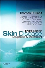 Skin Disease: Diagnosis and Treatment 3rd edi 2011