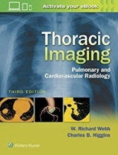 Thoracic Imaging : Pulmonary and Cardiovascular Radiology