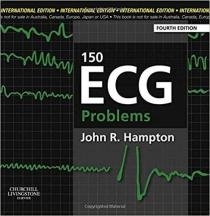 کتاب 150ECG problem