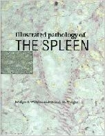 Illustrated Pathology of the Spleen