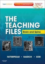 The Teaching Files: Brain and Spine : Expert Consult - Online and Print